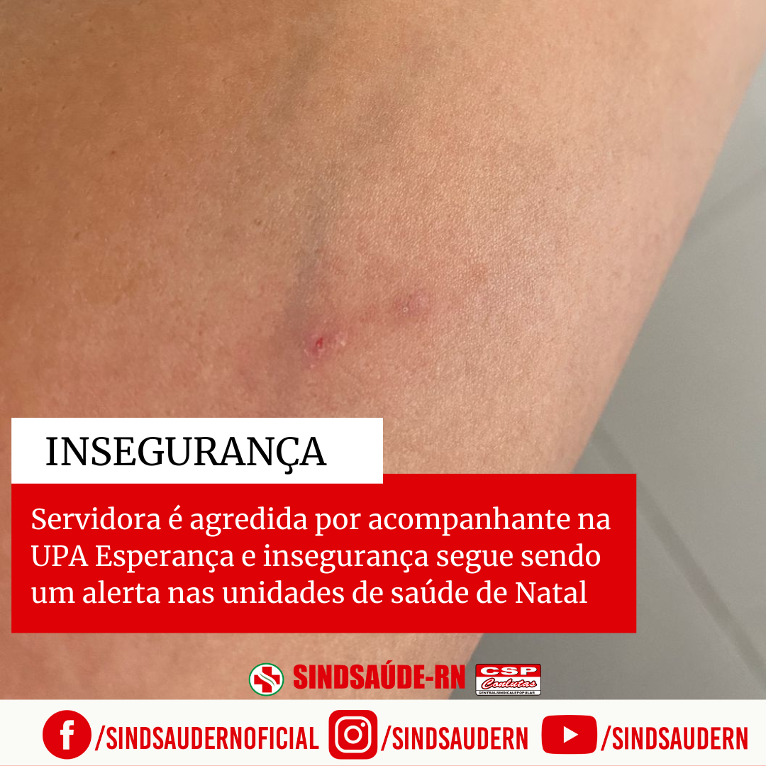 Imagem da noticia destaque maior